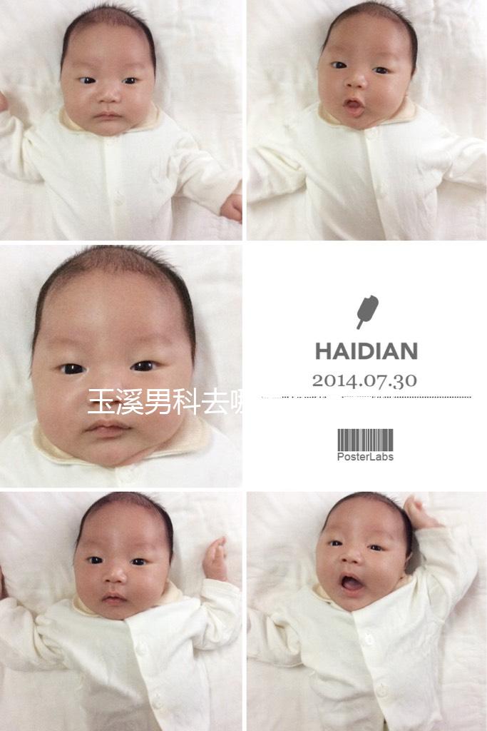 玉溪男科去哪家醫(yī)院看好,怎么選攻略,這個排行榜不要錯過