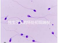 獨生子女的壞處初現(xiàn)端倪,贍養(yǎng)父母已成難題