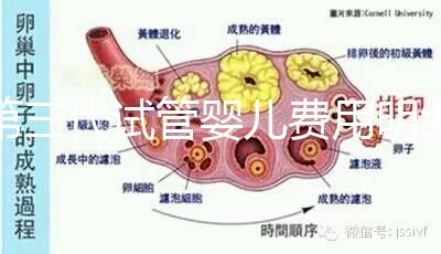 第三代試管嬰兒費(fèi)用明細(xì)