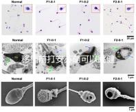 移植前打安蘇萌可以跳健身操嗎？你得到了嗎？
