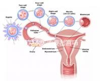 移植兩次失敗要刮宮嗎?做試管前這些問題得知道