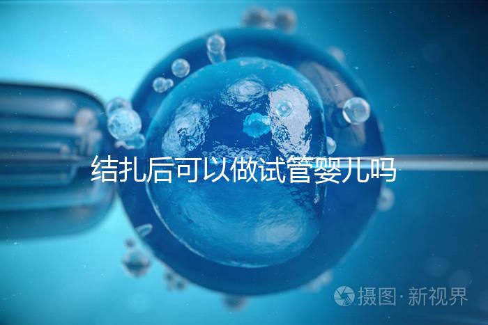結(jié)扎后可以做試管嬰兒?jiǎn)幔ńY(jié)扎后可以做試管嬰兒?jiǎn)豳M(fèi)用多少錢(qián))