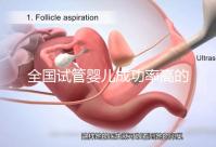 全國試管嬰兒成功率高的醫(yī)院有哪些?(全國試管嬰兒成功率高的醫(yī)院目錄一覽)