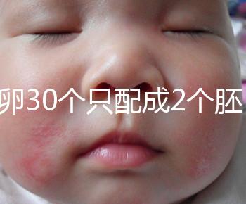 取卵30個(gè)只配成2個(gè)胚胎別放棄!卵巢傷口小移植成功率不低