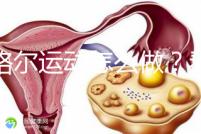 凱格爾運(yùn)動(dòng)怎么做?看看專業(yè)老師分享的分步驟圖解