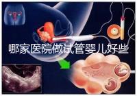 哪家醫院做試管嬰兒好些?