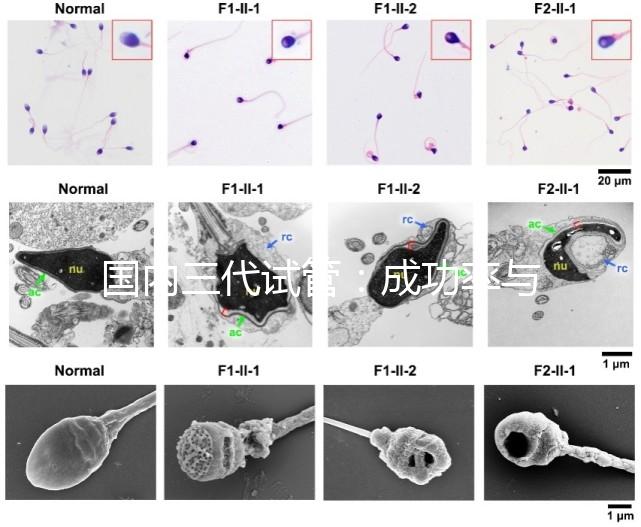 國內(nèi)三代試管：成功率與費(fèi)用全知曉？
