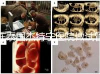 在泰國杰特寧醫(yī)院做試管嬰兒的費用明細(xì)和醫(yī)院排名清單,輕松規(guī)劃你的試管旅程!