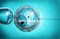 二胎做試管嬰兒的條件(試管二胎流程和費(fèi)用)