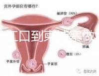 從丹江口到柬埔寨做第三代試管嬰兒怎么樣？要花多少錢？