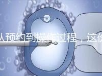 從預(yù)約到操作過(guò)程,這份tct檢查流程攻略請(qǐng)查收