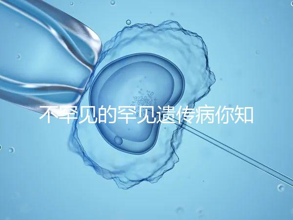 不罕見的罕見遺傳病你知道嗎？帶你認識下特納綜合癥