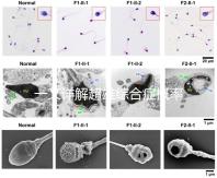 一文詳解超雄綜合癥概率有多大,想造的人多不多看過(guò)來(lái)