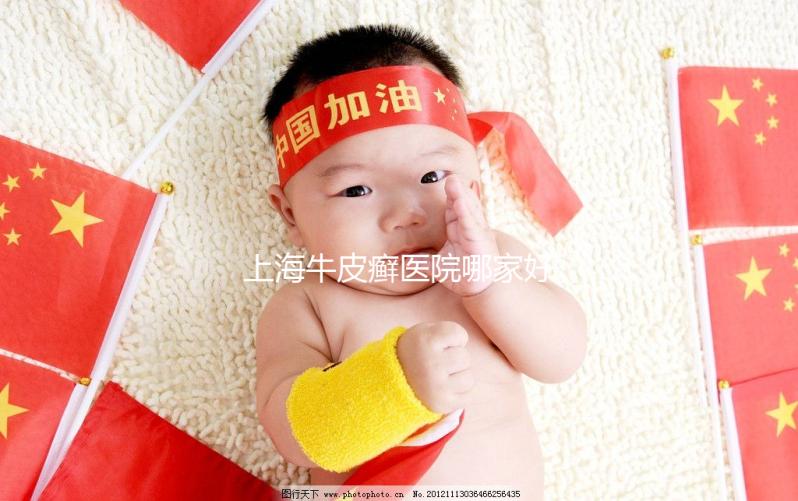 上海牛皮癬醫(yī)院哪家好