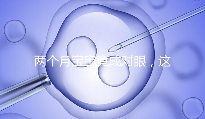 兩個月寶寶竟成對眼，這5大形成原因家長必知