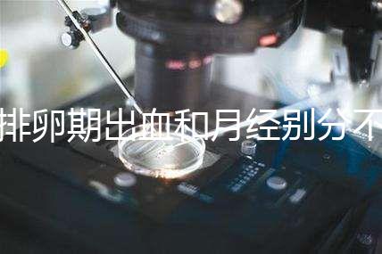 排卵期出血和月經別分不清,4大區(qū)別輕松判斷