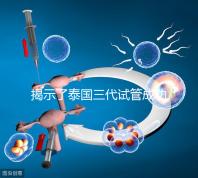 揭示了泰國三代試管成功率高的原因,以及優秀的技術 完美結合全方位服務