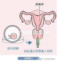 柳州幾個醫(yī)院能做第三代試管嬰兒?詳細(xì)的費用成功率都在這