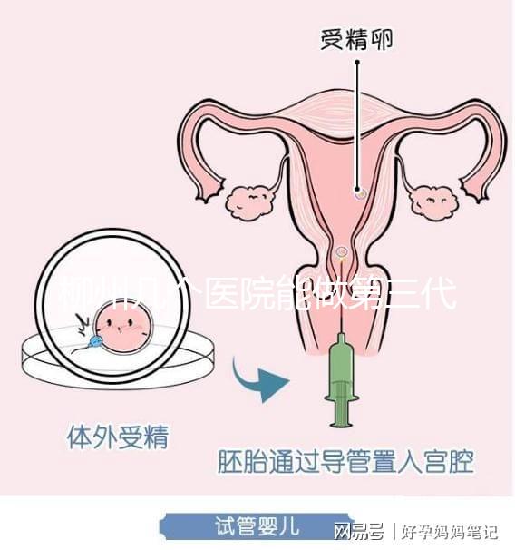 柳州幾個醫院能做第三代試管嬰兒？詳細的費用成功率都在這