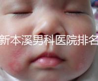 更新本溪男科醫(yī)院排名,不要錯(cuò)過本溪湖區(qū)top3醫(yī)生的專業(yè)