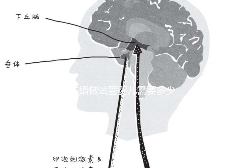 未婚做試管嬰兒需要多少錢？公立醫院費用大概在3-12萬