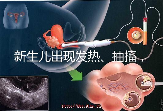 新生兒出現發熱、抽搐，很可能是胎毒的表現