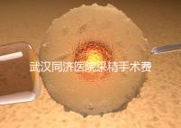 武漢同濟(jì)醫(yī)院采精手術(shù)費用分析，顯微采精也可報銷