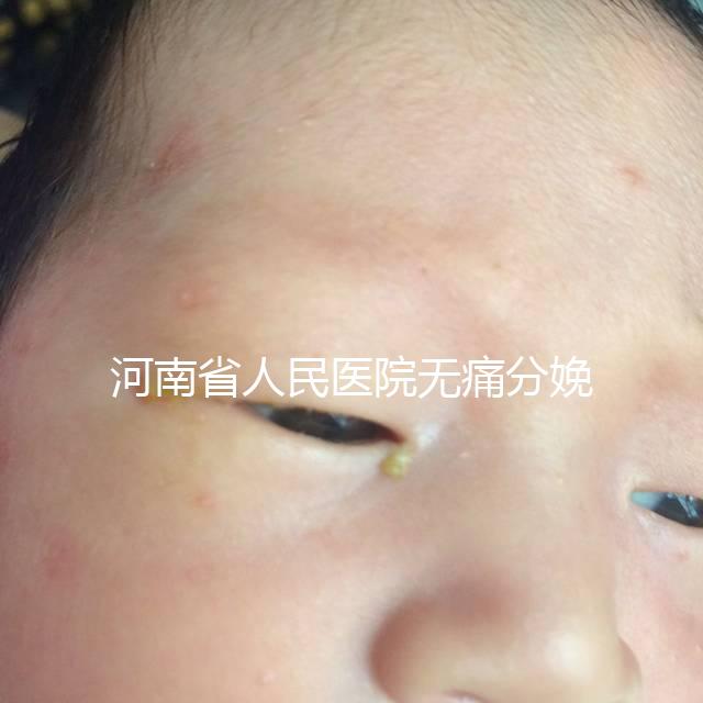 河南省人民醫院無痛分娩多少錢戳，收費標準60s看懂不踩坑