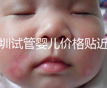 深圳試管嬰兒價(jià)格貼近百姓!三代試管只需8