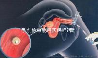 孕前檢查能用醫(yī)保嗎?看看過來人都是怎么說的
