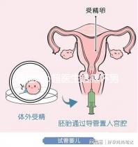 孕檢時(shí)b超醫(yī)生透露懷男寶女寶暗語(yǔ)寶典,一語(yǔ)戳中有心人!