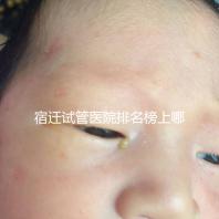 宿遷試管醫院排名榜上哪家好,不造助孕成功率和費用別亂選