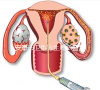 安康市衛(wèi)生計生局:普及優(yōu)生優(yōu)育五項檢查相關(guān)知識