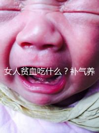 女人貧血吃什么？補氣養血，掌握這五個技巧，讓你煥發青春光彩