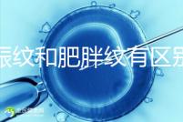 妊娠紋和肥胖紋有區別,教你3種“花紋”診斷鑒別的方法