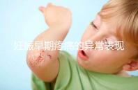 妊娠早期疼痛的異常表現(xiàn)是什么?