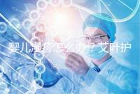 嬰兒濕疹怎么辦？艾葉護(hù)理不一定管用，4個小妙招輕松治療