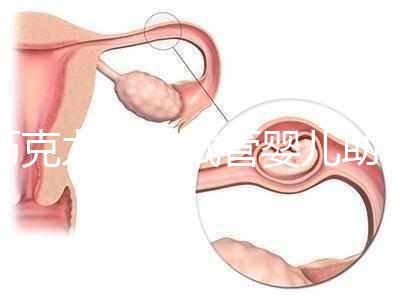 巧克力囊腫試管嬰兒助孕應先治療？網友看法均有差異