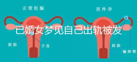 已婚女夢見自己出軌被發(fā)現(xiàn)什么意思來瞧，或和心理有關(guān)系