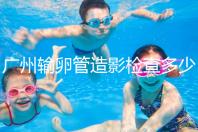 廣州輸卵管造影檢查多少錢,預約時間一次說清楚,想去看