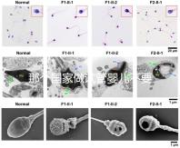 那個國家做試管嬰兒不要結婚證