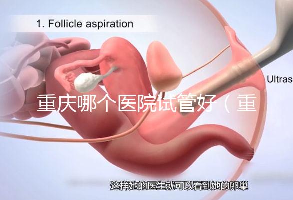 重慶哪個(gè)醫(yī)院試管好(重慶哪個(gè)醫(yī)院試管好一點(diǎn))