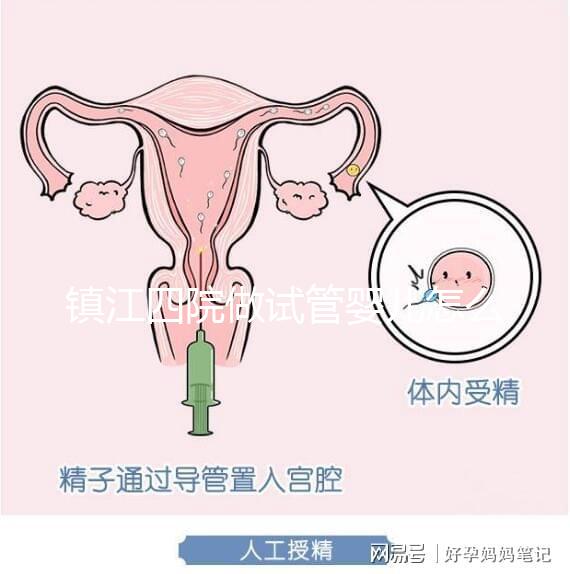 鎮(zhèn)江四院做試管嬰兒怎么樣?具體成功率費用介紹