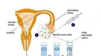 降調,進周,囊胚……這些試管嬰兒助孕術語你都懂嗎?
