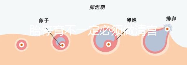 胎停育不一定必須做清宮！不滿足這3種情況,無需要刮宮