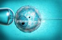 臍帶血捐贈(zèng)后萬一自己要用怎么要早知,懷孕的趁早了解