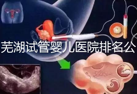 蕪湖試管嬰兒醫(yī)院排名公開,弋磯山醫(yī)院、蕪湖二院獲好評(píng)