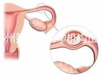 蘇州第三代助孕機構正規可靠嗎？實地考察才為真