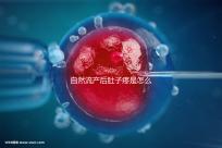 自然流產后肚子疼是怎么回事