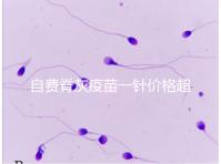 自費脊灰疫苗一針價格超200！與免費糖丸相比各有優缺點